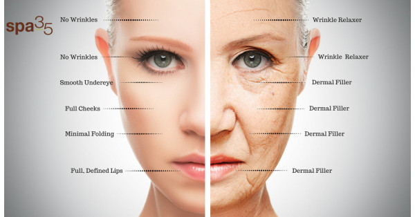 Botox vs. filler dermici: qual è la differenza?