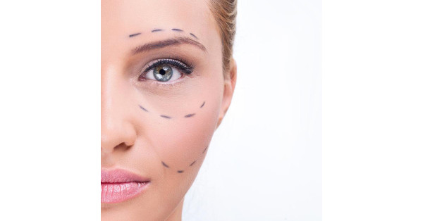 Under-Eye Fillers: Do They Really Work for Dark Circles? Under-Eye Fillers: Do They Really Work for Dark Circles?