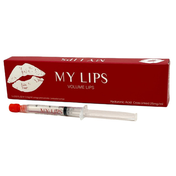 My Lips - Filler Volume Lips 25Mg/Ml Siringa Preriempita Confezione 1 x 3 Ml
